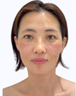 40代女性のアフター