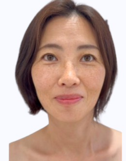 40代女性のビフォー